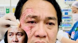 PERBEDAAN DAFTAR PELAKU PENYIRAMAN AIR KERAS ANDRIE YUNUS: POLISI UMUMKAN 2 ORANG, TNI 4 PERSONEL