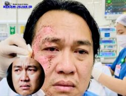 PERBEDAAN DAFTAR PELAKU PENYIRAMAN AIR KERAS ANDRIE YUNUS: POLISI UMUMKAN 2 ORANG, TNI 4 PERSONEL