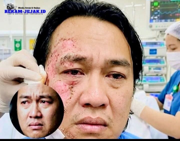 Screenshot 20260320 130259 Facebook